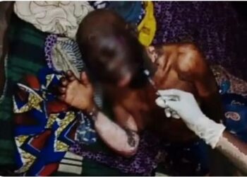 ‘My prophet said she’s behind my predicament’ – Daughter sets 86-yr-old mother ablaze; dies in hospital