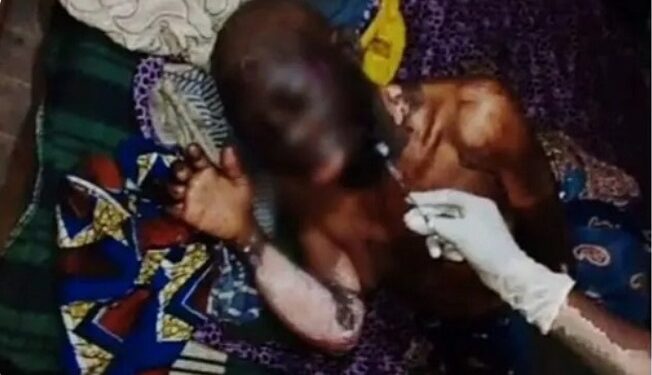 ‘My prophet said she’s behind my predicament’ – Daughter sets 86-yr-old mother ablaze; dies in hospital