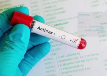 Re-emergence of Anthrax Highlights Public Health Risks in Nigeria