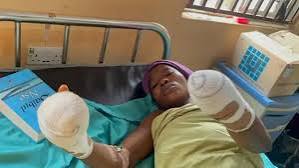 ‘How my husband used knife to cut off my hands’ — woman opens up