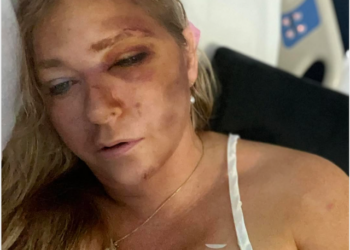 Virginia Giuffre, known for her legal battles against Jeffrey Epstein and Prince Andrew, Gravely Ill