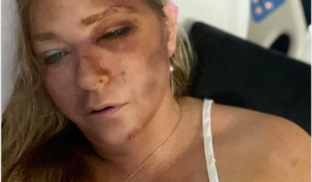 Virginia Giuffre, known for her legal battles against Jeffrey Epstein and Prince Andrew, Gravely Ill