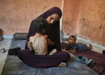 Gaza’s Doctors Collapse from Hunger While Treating Starving Patients