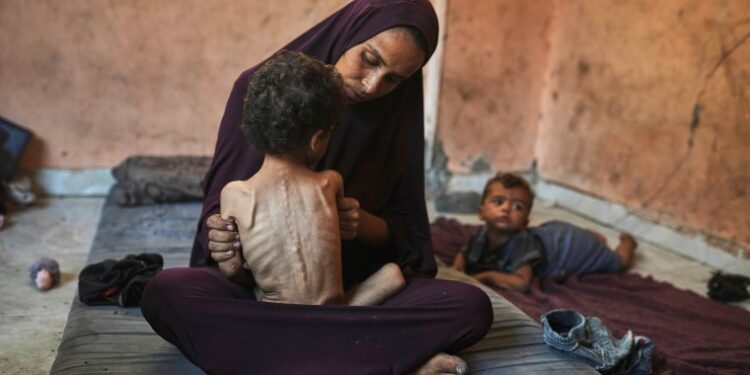 Gaza’s Doctors Collapse from Hunger While Treating Starving Patients