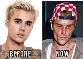 Justin Bieber Admits He Tested Positive For…