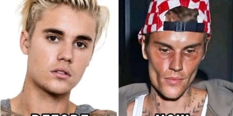 Justin Bieber Admits He Tested Positive For…