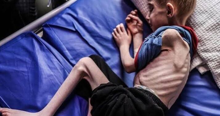 More Deaths from Hunger as Gaza Faces New Evacuation Deadline