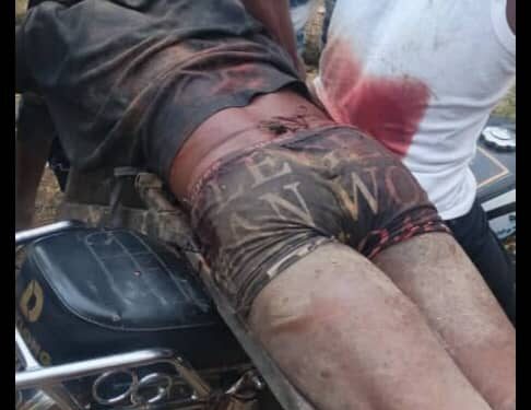 Armed Men Attack Ikom Community, Youth Shot Amid Land Dispute