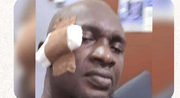 Abia Lawmakers in Bloody Clash Over Cash Gift