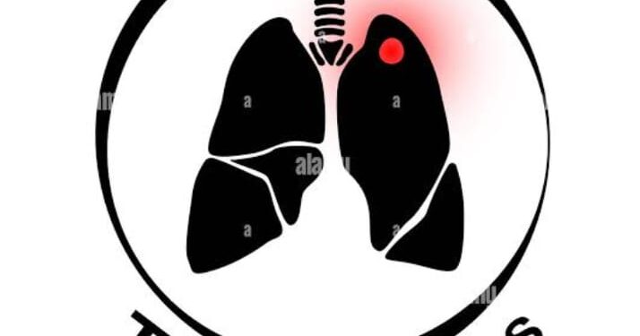 Soaring TB Cases Sparks Alarm as Stakeholders Urge Stronger Govt. Action