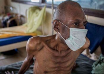 TB Cases Fall For First Time Since 2020, Says WHO