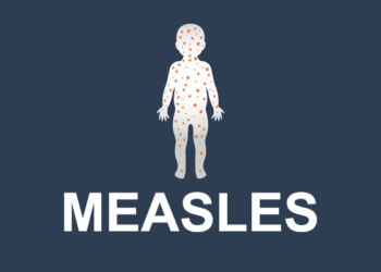 Measles Deaths Reduced by 88%; Vaccination Saved 58.7 Million Lives Globally – WHO