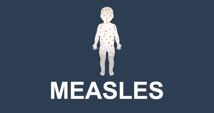 Measles Deaths Reduced by 88%; Vaccination Saved 58.7 Million Lives Globally – WHO