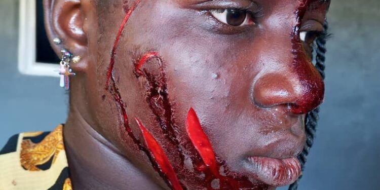 Woman Attack 17-year-old Teenager For Allege Affair With Husband in Taraba