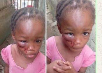 Pastor’s Wife Arrested in Calabar for Allegedly Brutalizing 5-Year-Old Niece