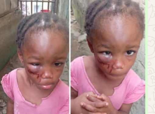 Pastor’s Wife Arrested in Calabar for Allegedly Brutalizing 5-Year-Old Niece