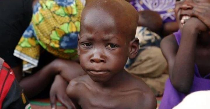 Enugu, Benue Secure U.S.-UNICEF Grant to Tackle Malnutrition