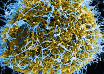 ‎JUST IN: France Records First Confirmed Ebola Infection