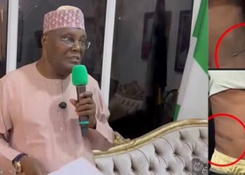 Tinubu’s Harsh Economic Policies Pushing Young Nigerians to Sell Their Kidneys to Survive: Atiku ‎